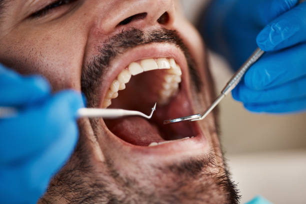 Best Emergency Cosmetic Dentistry (e.g., broken veneers) in Connell, WA