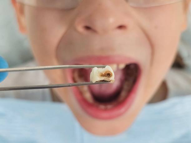 Best Urgent Dental Care for Toothaches in Connell, WA
